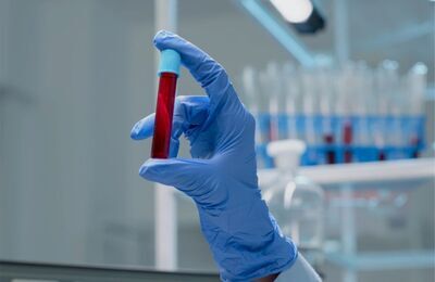 Лабораторные анализы от 200₽